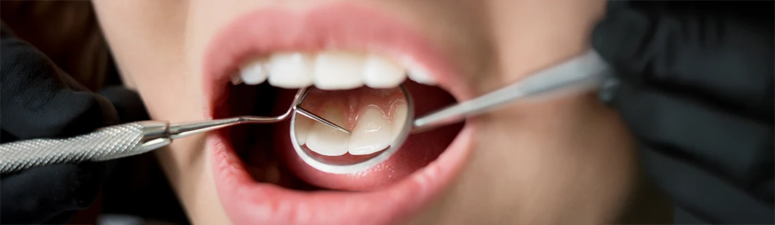 Woman At Dentist Getting Check Up